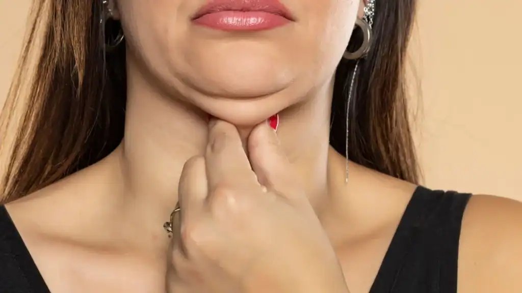 An image of a woman with double chin, sad, worried : Non Surgical Double Chin Removal Treatment in Whitley Bay, UK