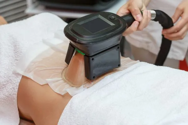 Image of person having fat freezing treatment to help weight gain Whitley Bay