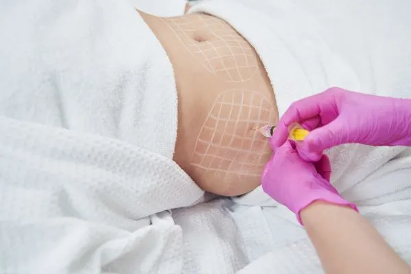 image of fat dissolving injections on love handles to help combat weight gain Whitley Bay