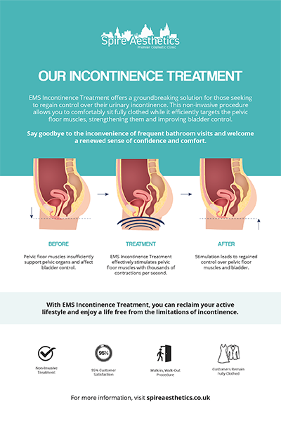 image to show how EMS treatment works for female urinary incontinence Whitley Bay