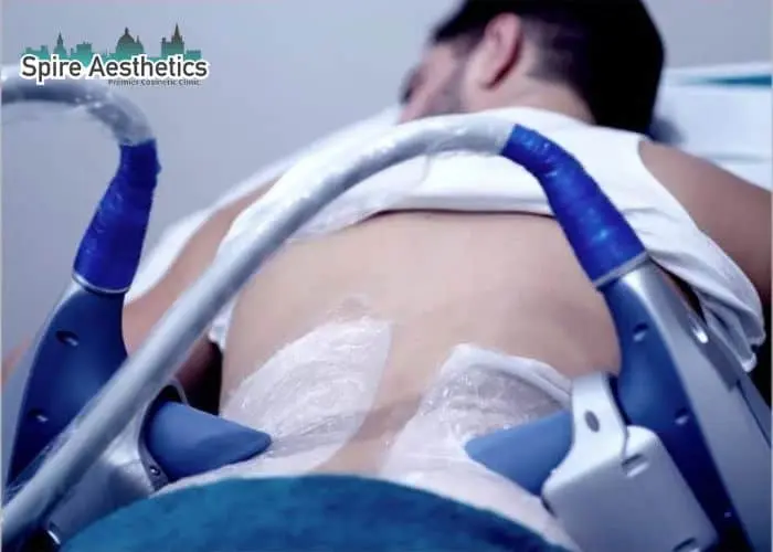 Man having fat freezing treatment done on love handles before a competitions Whitley Bay to create a sculpted look.