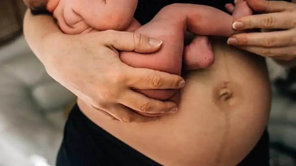 Why Is My Stomach Still Big After Pregnancy Whitley Bay?